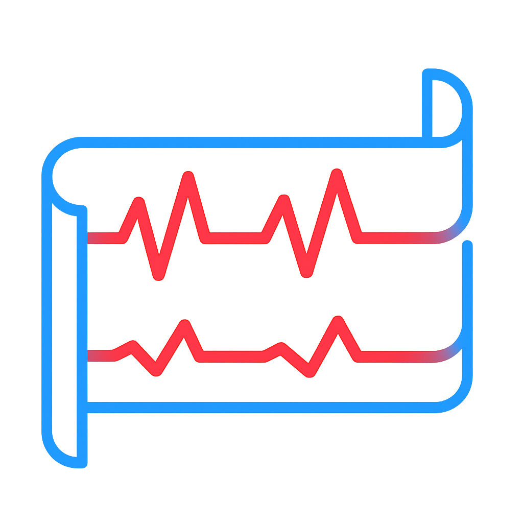 ecg