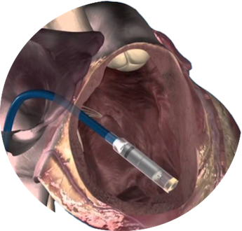 βηματοδοτης copy